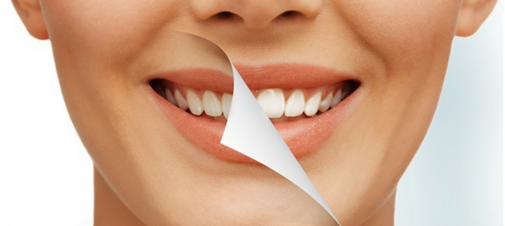 Teeth Whitening: Different Ways to Whiten Your Teeth